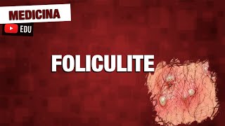 Foliculite bactéria causadora patologia e tratamento [upl. by Perloff415]