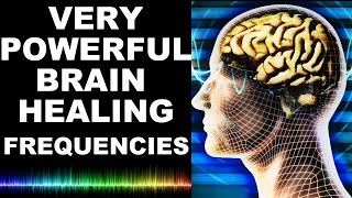 EXTREME BRAIN HEALING FREQUENCIES FOR STUDY FOCUS MIND POWER CONFIDENCE MEDITATION  MUST TRY [upl. by Attinahs]