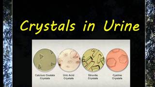 Urine Examination3 Crystals [upl. by Dhumma263]