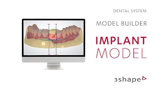 3Shape Dental System  Model Builder  Implant Model [upl. by Aicirtel]