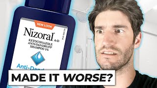 Nizoral Shampoo For Hair Loss  THE TRUTH [upl. by Htesil]