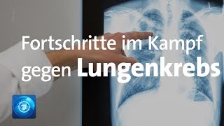 Lungenkrebs – Die unterschiedlichen Therapiemöglichkeiten [upl. by Bayard]