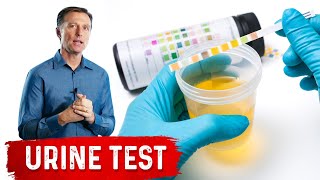 Urine Test Simplified [upl. by Ariajay572]