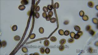 Toxic House Mold Under the Microscope [upl. by Leasia138]