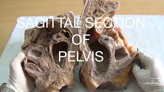 SAGITTAL SECTION OF PELVIS  DEMONSTRATION  ANATOMY [upl. by Enilraep]