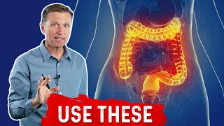 What is Ulcerative Colitis – Causes Symptoms amp Treatment by DrBerg [upl. by Evilc]