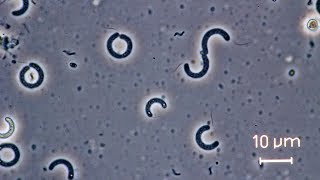 Spirilla bacteria seen through a compound microscope [upl. by Hanad]