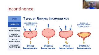 4 Cystoscopy for Patients [upl. by Moreland]