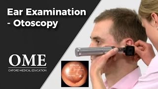 Otoscopy Ear Examination  ENT [upl. by Llemert]