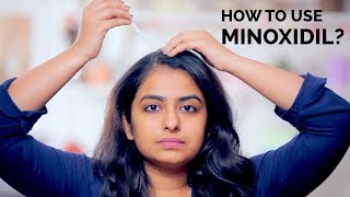 How To Use Minoxidil  Hair Regrowth  Skin Diaries [upl. by Hayyim158]