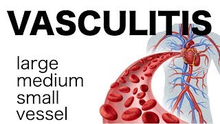 Vasculitis [upl. by Semela]