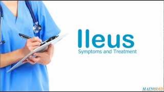 Ileus Symptoms and Treatment [upl. by Latini182]