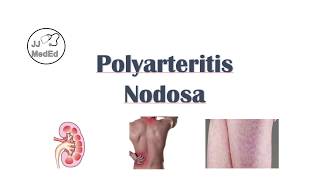 Polyarteritis Nodosa PAN  Signs amp Symptoms Diagnosis Treatment [upl. by Aiykan]