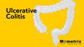 Ulcerative Colitis  NCLEX Review [upl. by Kenn]