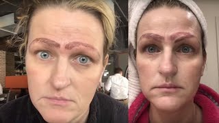 MICROBLADING FAIL Woman has 4 eyebrows [upl. by Beard86]