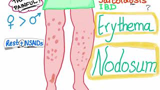 Erythema Nodosum [upl. by Petronille]