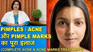 PimplesAcne और Pimple Marks का पूरा इलाज  Complete Treatment of Acne amp Acne Marks [upl. by Tanitansy278]