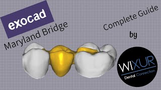 Exocad  Maryland Bridge metalfree [upl. by Paviour]