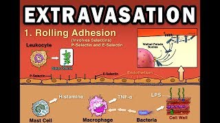 EXTRAVASATION [upl. by Alah]