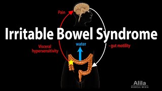 Irritable Bowel Syndrome IBS Signs amp Symptoms  Reasons for Why Symptoms Occur [upl. by Wilmer]