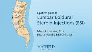 Lumbar Epidural Steroid Injections [upl. by Aicillyhp73]