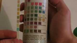 How to perform Urinalysis [upl. by Ydak]