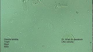 Giardia lamblia intestinalis trophozoite [upl. by Ahtiuqal652]