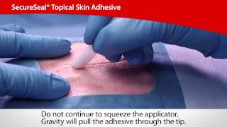 SecureSeal® Topical Skin Adhesive  Cardinal Health [upl. by Dnana497]