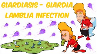 Giardiasis  Giardia lamblia Infection [upl. by Adniles391]