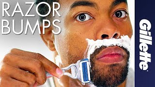 Help Prevent Razor Bumps amp Ingrown Hairs  Gillette SkinGuard [upl. by Jasper]