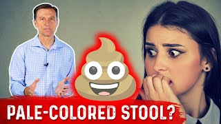 What Does PaleColored Poop Mean – DrBerg [upl. by Asiruam]