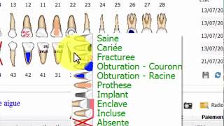 LOGICIEL DENTAIRE AppDent  ODONTOGRAM [upl. by Renee]