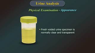 Urine Analysis [upl. by Alithia713]