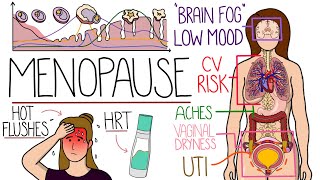 Menopause Explained Clearly Includes HRT amp Perimenopause [upl. by Gaylor]