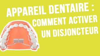 Orthodontie  Comment activer son disjoncteur [upl. by Caassi]