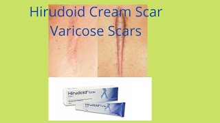 Hirudoid Forte and Hirudoid cream scar varicose bruses inflammation acne skin veins care [upl. by Squires]