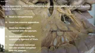 GENERAL SURGERY Small bowel obstruction vs large bowel obstruction vs Ileus [upl. by Avevoneg]