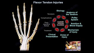 Flexor Tendon Injuries  Everything You Need To Know  Dr Nabil Ebraheim [upl. by Ardied]