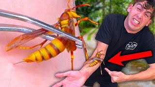 STUNG by an EXECUTIONER WASP 7 times [upl. by Farver]