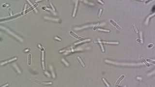 Bacillus spp [upl. by Eves]