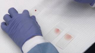 Making and staining blood smears [upl. by Airdnekal]