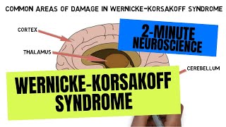 2Minute Neuroscience WernickeKorsakoff Syndrome [upl. by Danice621]