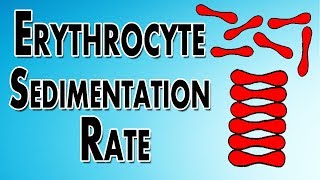 Erythrocyte Sedimentation Rate [upl. by Reamy]