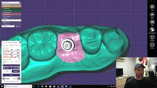 How to Create Implant Models from Intra Oral Scans [upl. by Aennyl]