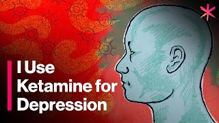 I Use Ketamine for Depression  Here’s How It Works [upl. by Becker]