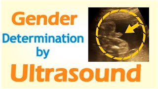 Gender Determination by Ultrasound [upl. by Seafowl]