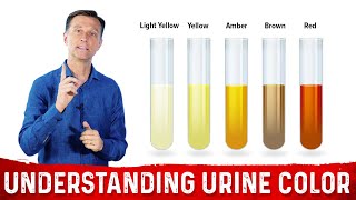 What Urine Color Indicates About Your Body – DrBerg [upl. by Novelia]