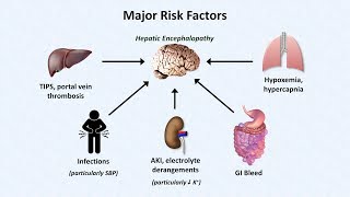 Hepatic Encephalopathy [upl. by Radke]