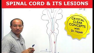 Spinal Cord Injury and its Lesions  Neuroanatomy [upl. by Notsuoh]