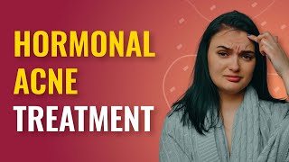 Hormonal Acne Treatment How to Get Rid of Hormonal Acne  MFine [upl. by Austen931]